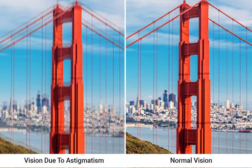 astigmatism vision